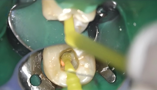 5a9c0736-ed46-a96a-5d74-d79ea63c5997.png 5a9c0736-ed46-a96a-5d74-d79ea63c5997.png