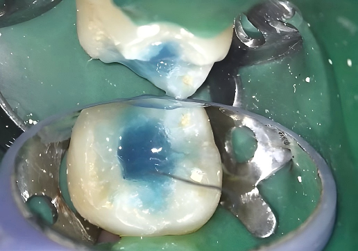 ab222a90-8a50-a379-8827-463b1cb74ab8.png ab222a90-8a50-a379-8827-463b1cb74ab8.png