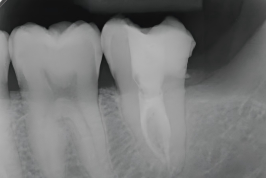 cb1969bd-e753-ffb5-d668-f93c47f1362f.png cb1969bd-e753-ffb5-d668-f93c47f1362f.png